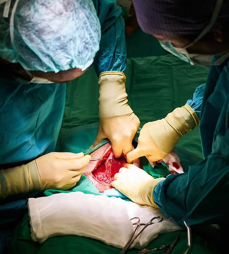 SURGICAL INSTRUMENTS